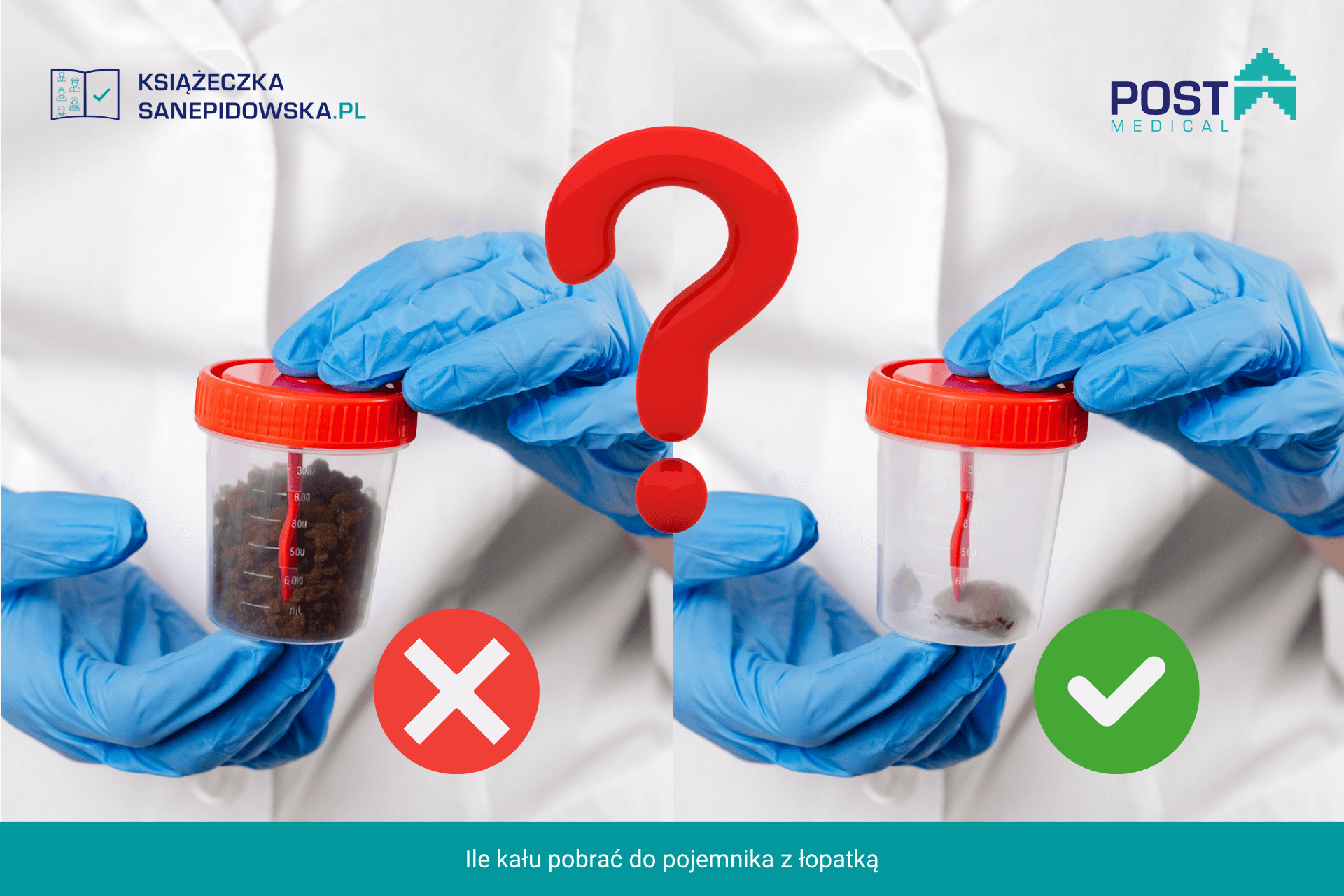 Ile kału pobrać do pojemnika z łopatką?