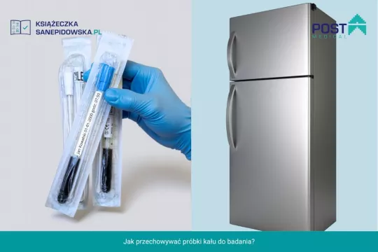 Jak przechowywać kał do badania sanepidowskiego?